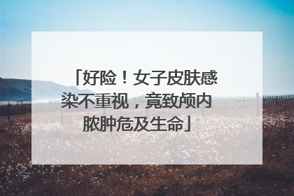 好险！女子皮肤感染不重视，竟致颅内脓肿危及生命